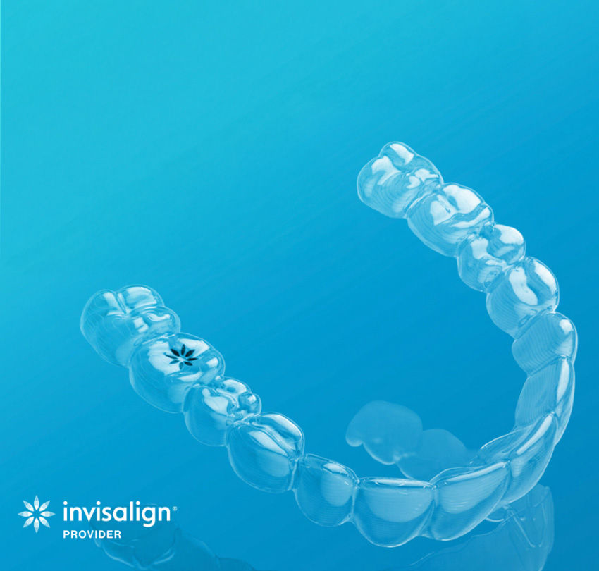Invisalign-850x810-03-OPT