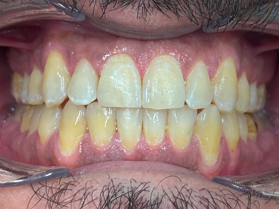 26450714_Jose_Guevara_8_Anterior 1